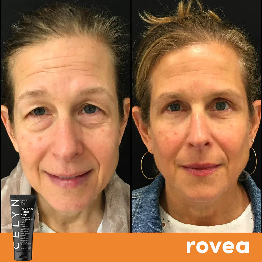 Crème Anti Cernes et Rides Instantanée | ORIGINALE